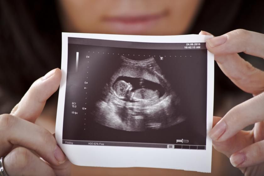 Медики розповіли, що ненароджені діти можуть відчувати біль вже на 12 тижні вагітності. Звідси виникає припущення, що під час абортів плід зазнає страждань.