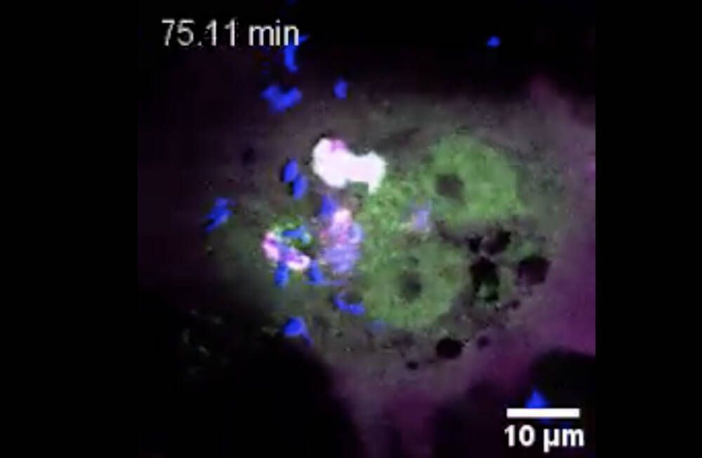 Науковці вперше зафіксували на відео смерть клітини, яка заражена туберкульозом. Можна побачити, як інфекція поширюється по всьому організму.