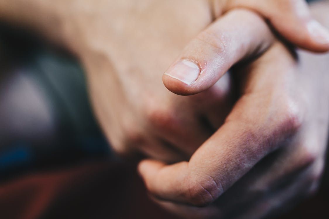 Про що свідчить пожовтіння нігтів — 7 причин, які пов'язані зі здоров'ям та з зовнішніми факторами. Розбираємося у головних причинах зміни кольору.