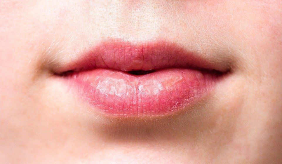 Як повернути потрісканим губам колишню пухкість і привабливість. Потріскані губи можна зробити гарними.