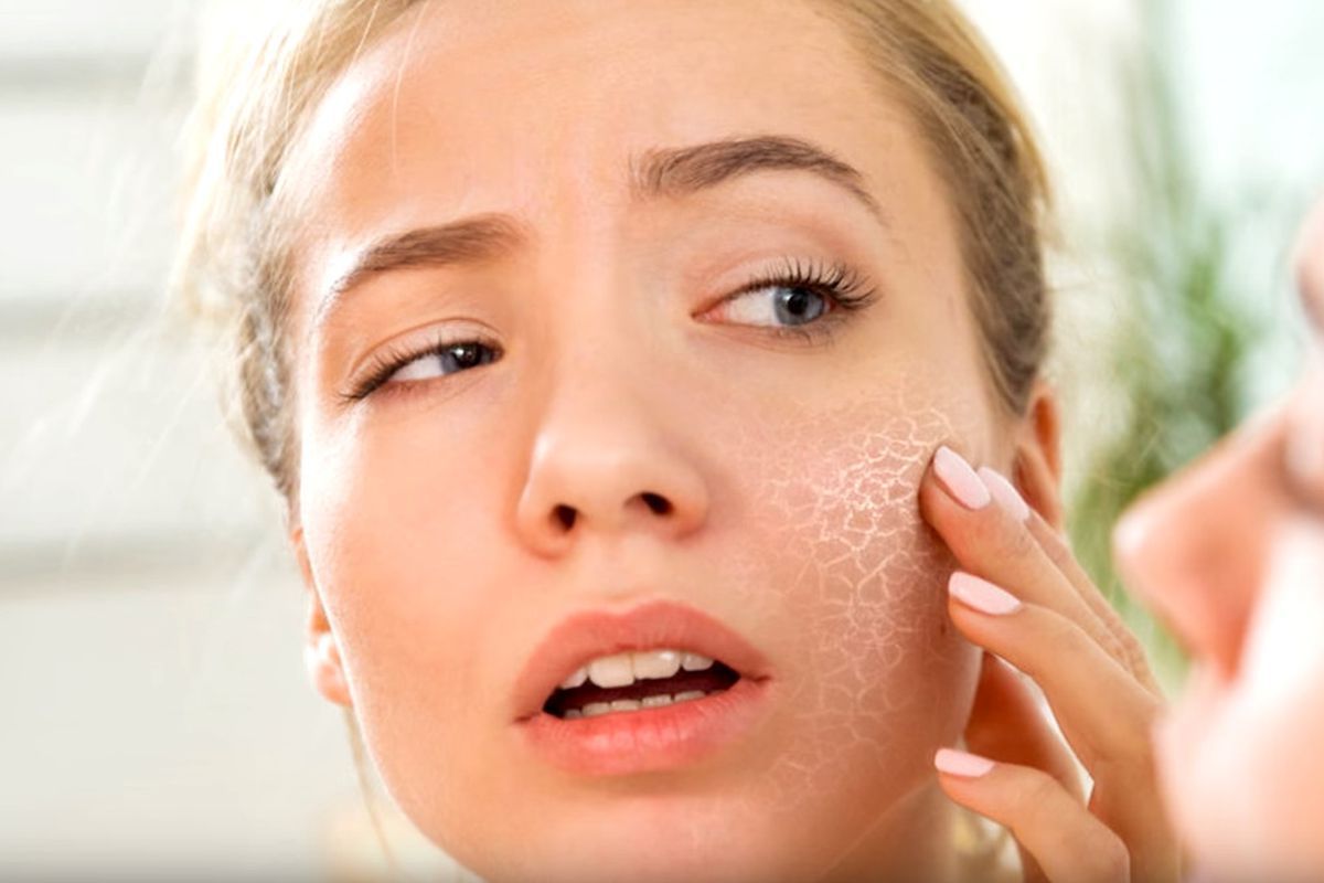 Кілька причин, які сприяють сухості шкіри вашого обличчя. Шкіра обличчя може бути сухою з різних причин.