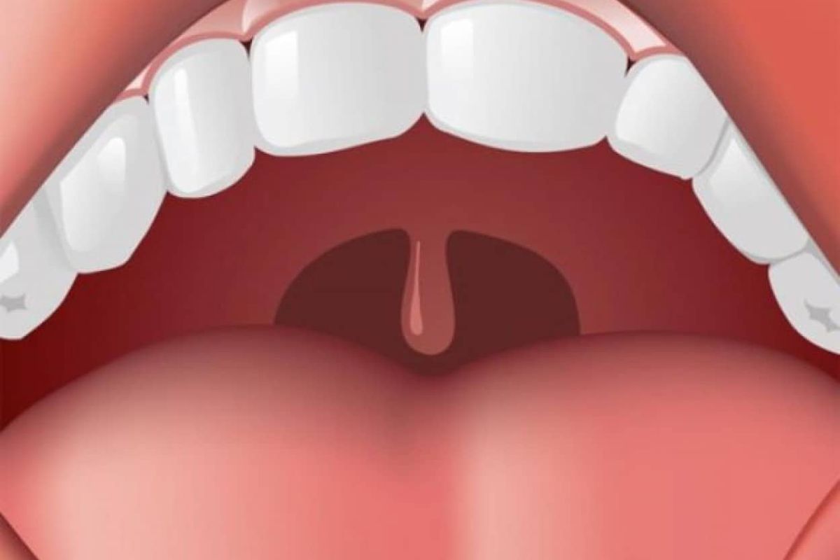 Ось для чого нам потрібен цей маленький язичок в горлі. Цей язичок — одна з найдивніших особливостей людського тіла.