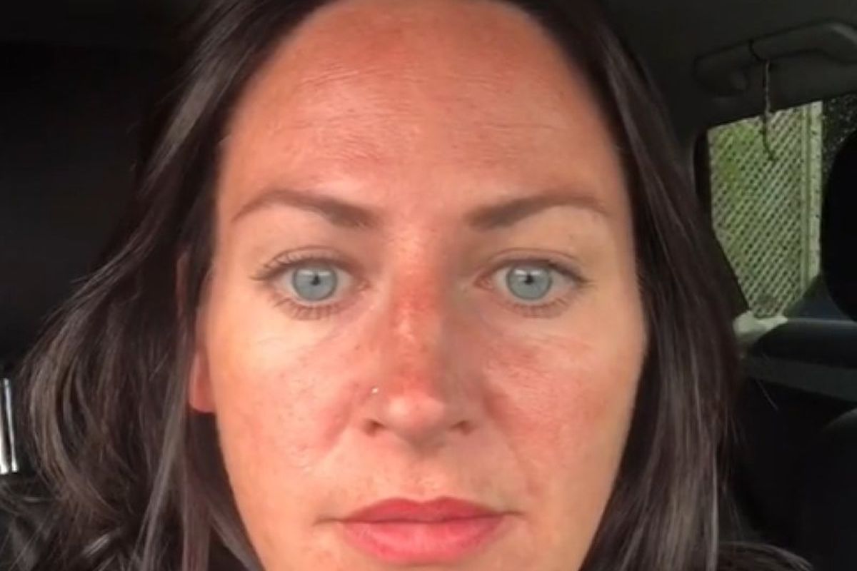 Блогерка показала обличчя без зморшок після першої ін'єкції ботоксу. Своїм перетворенням жінка здивувала підписників.