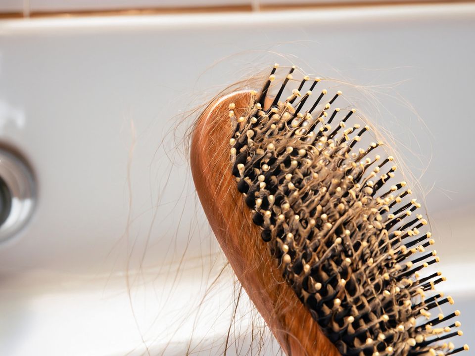 4 причини випадання волосся: поради трихологів. Фахівці вказали низку причин, через які може «танути» ваша шевелюра.